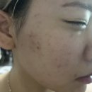 토토홈케어 | 여드름피부 세멘시트 내돈내산 모공팩 솔직한후기(세멘시트팩+카멘시트+인헨서+세멘잘라이트)