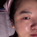 솔향기피부샵 | 의정부 피부관리 솔향기 제대로 힐링하고 왔어요