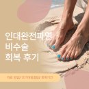 예손병원 | 인대완전파열 비수술 회복 후기(꿀팁, 족부전문병원, 회복기간, 예손병원, 회계사 시즌중)