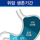 위암 3기 4기 위암 말기 위암 병기 생존율 위암치료 위암 발생 원인 증상 이미지