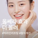 라임힐 | 부천울쎄라 총정리 (원리/효과/유지기간/피프라임과 차이점/후기 등)