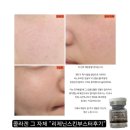 선 피부샵