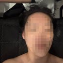 씨유 디지털엠파이어1호점 | 망포여드름관리 끝판왕 몽스킨 서큘테라피