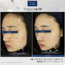 밀리의원 네이버블로그