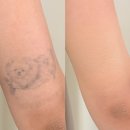 청라3동행정복지센터(6) | 인천 커버킹 웨딩촬영 타투커버 디어브로우청라눈썹&amp;셀핏바디피부