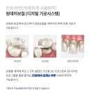 정도치과기공소 이미지