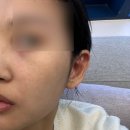 선메디칼(주) | 강남역피부과 웨딩관리로 핫한 볼링크 4D 내돈내산 후기