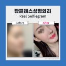 탑클래스성형외과의원 이미지