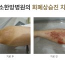 미아경희365한의원 네이버블로그