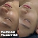 라파 피부마사지 | 김포피부관리 라파에스떼 수분충전 브라이팅 관리 효과 후기