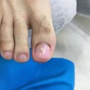 푸스케어 남포점 글림네일 이미지