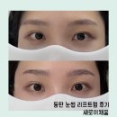 아이그린안경원 - 창원시 의창구 | 동탄눈썹 새로이채움 눈썹문신 브로우리프트펌 잘하는 곳 만족후기 재방문의사있음