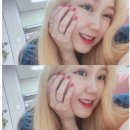 잠실 치과🦷 / [ 치아 미백 시술 ] 전후 효과, 후기 / 잠실새역,삼전역 부근 치과 추천