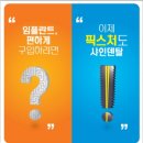 샤인덴탈 이미지