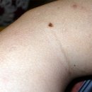 남수한의원 | 남수침술원 예약 및 진료기 (구당 김남수님의 뜸사랑)