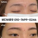 비로우