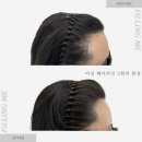미가헤어라인 이미지