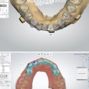 이엘치과의원 | 여주 충치 치과, 과잉 진료가 걱정된다면?