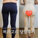 새침하개멍 | 부산허파고리 당일 상세 후기 (feat. 흉터 붓기 멍)