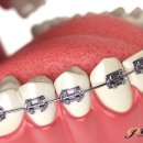 프라임치과기공소 이미지