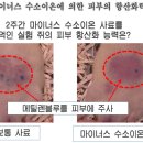 수소수이야기 이미지