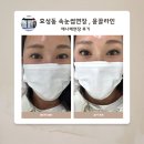 (인천) 효성동 속눈썹연장 윤끌라인 , 눈 2배 커보이는 애니메연장 후기