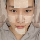 피부관리 수지 셀린 피부과 후기