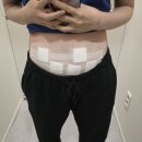 도달 | 수원 마운자로 대신 지방분해주사 3회로 49kg 도달한 후기