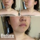 킴에스테틱 | 달서구 피부관리 잘하는 달서구에스테틱 킴그린스킨앤바디