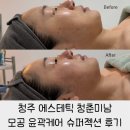 미남체육관 | 청주 에스테틱 청춘미남 윤곽라인과 탄력 모두 잡아주는 심는 필러 슈퍼젝션 후기