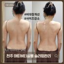 전주 아트 살롱 | 전주 삼천동 아띠뷰티살롱 에어바디 슬리밍 관리로 승모근 비대칭 붓기 고민 한 번에 해결!