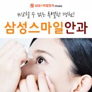 삼성스마일안과의원 네이버블로그