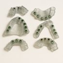 현신경과의원 | 산성동치과 임플란트 디지털로 덜 아프게