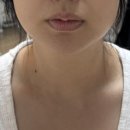 고려리프트 | 뷰티디바이스 리프팅, 내돈내산 홈모드 후기(홈모드써마리프트 언박싱)