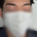 [강남] 강남역 눈썹 문신 강남 반영구 잘하는 곳 ‘드보라 의원‘ 추천!