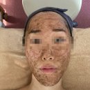 엘뷰티 남포점 | [안나뷰티]부산 <엘뷰티 남포점>에서 원데이필(약초필) 받고 왔어요 !