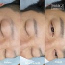 미모헤어라인
