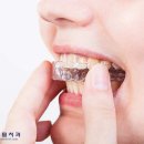 연세필치과교정과 이미지