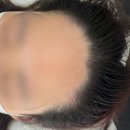 미작뷰티 수원점 인계동 헤어라인문신 잘하는 곳 추천 후기