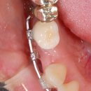 강남프라임덴탈 이미지