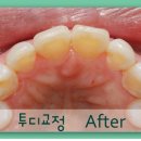 투디(2D)치과의원 이미지