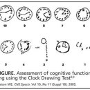 시계 그리기로 해보는 치매 검사 이미지