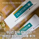 에스오에스 | 무너진 피부 장벽 관리에 사용한 닥터스테른 에스오에스리피드덱스감마크림, 악건성 피부 사용 후기