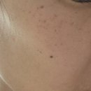 크림성형외과의원 이미지