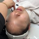 사랑투휴게점 | 대구피부관리 가꾸다 투턱라인 고민해결 더마리프핏 전후 차이