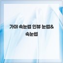 인뷰