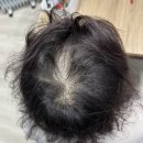 미지예피부과의원 이미지