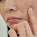 이은피부과 이미지