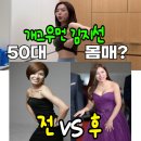 김지선 | 아이 넷 모유수유 후 가슴 다 망가진 55세 김지선 가슴수술 후기(+ 비용 방법 등 총정리)
