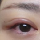 송안과의원 이미지